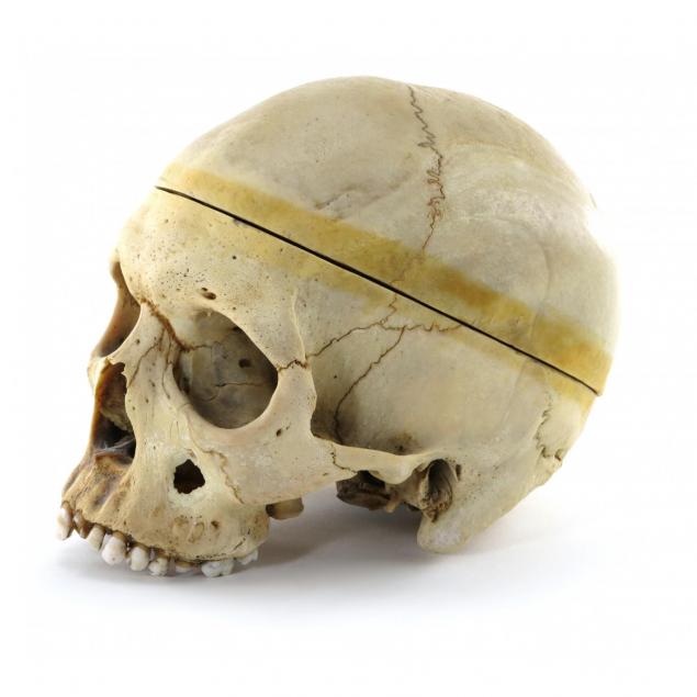 human-skull